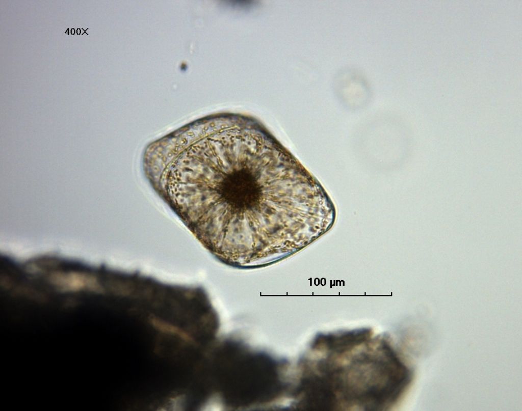 Isthmia nervosa Kuetzig ---diatomea--- (esemplare vivo)